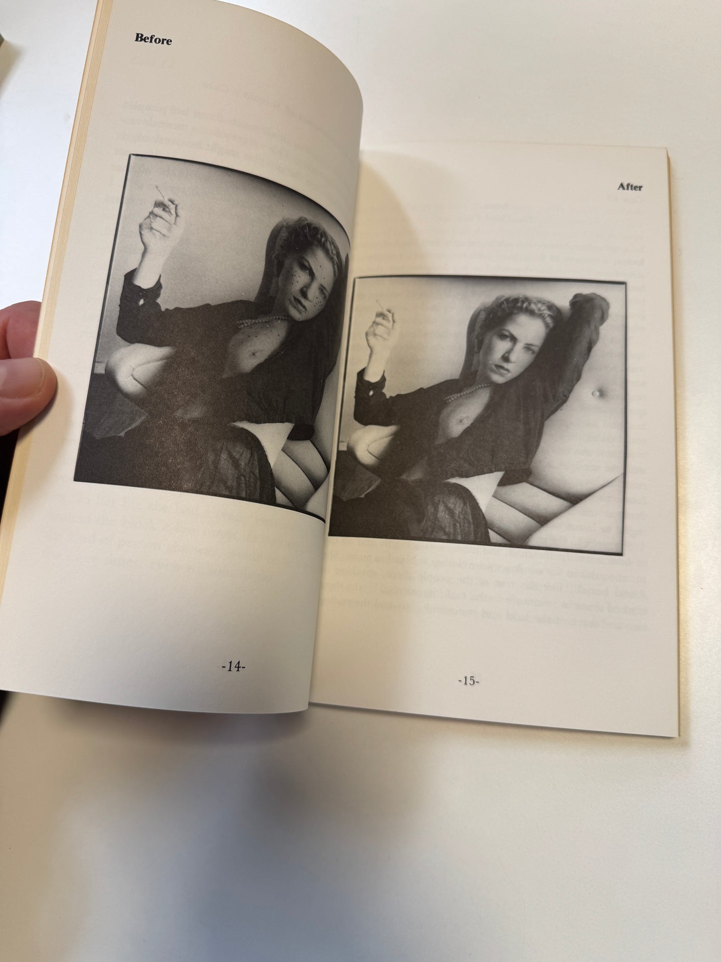 COOKIE MUELLER / How to Get Rid of Pimples