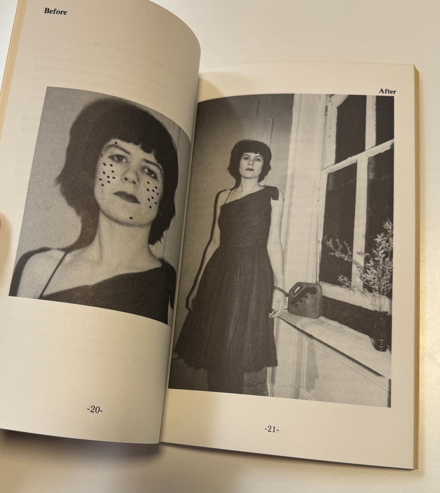COOKIE MUELLER / How to Get Rid of Pimples