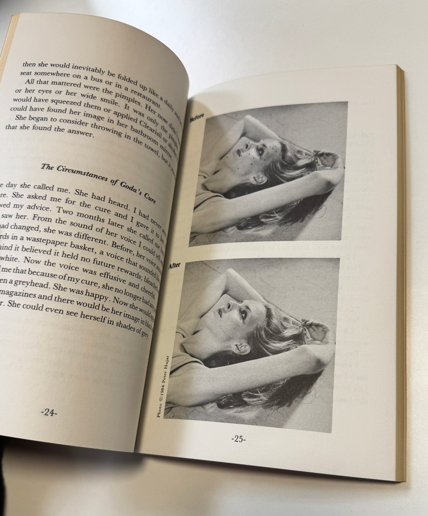 COOKIE MUELLER / How to Get Rid of Pimples