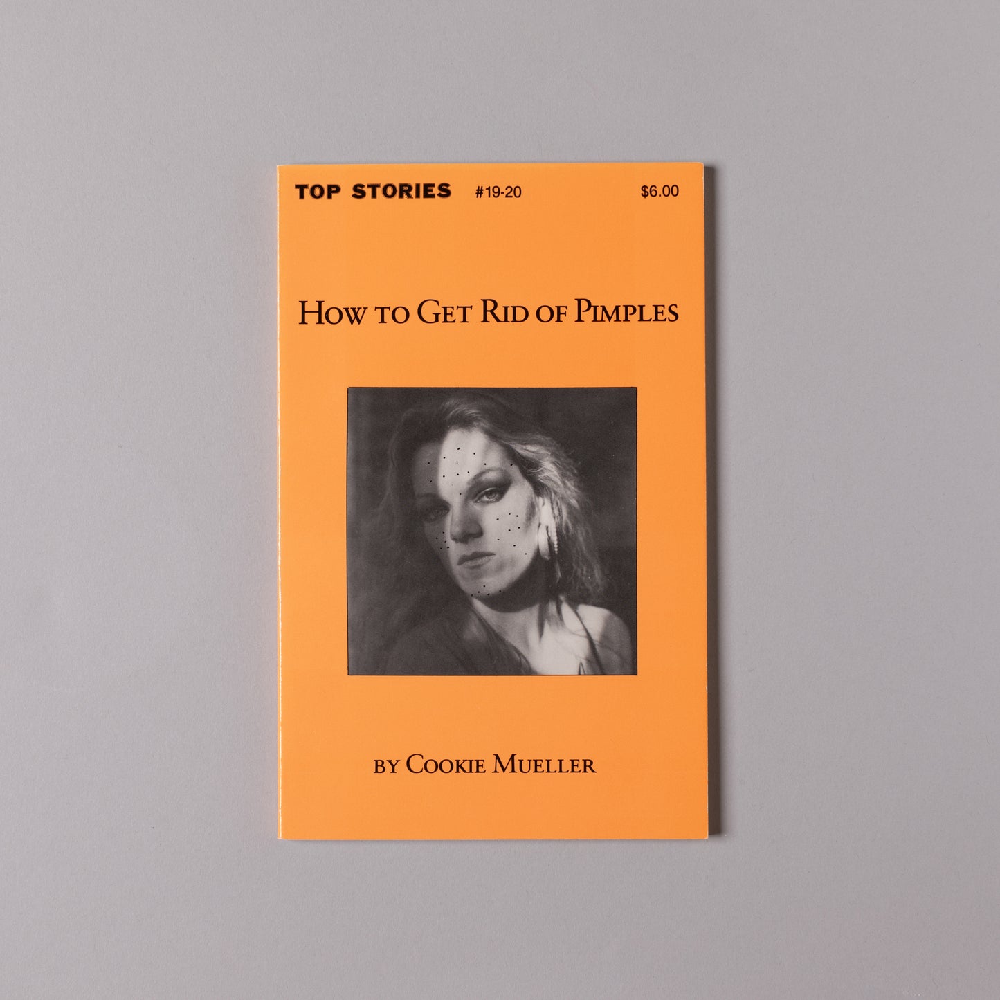 COOKIE MUELLER / How to Get Rid of Pimples